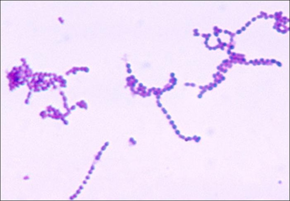 A micrograph of small purple circles chained together in clumps.