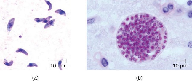 A) A micrograph of curved cells with a nucleus. B) micrograph of a sphere with many smaller spheres inside.