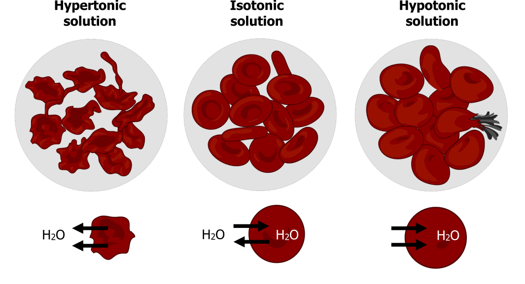 Hypertonic solution: Water leaves the cells and the cells appear shriveled. Isotonic solution: Equal movement of water in and out of the cell and cells appear circular with indentions in the middle. Hypotonic solution: Water moves into the cells and cells appear larger, with one cell exploding.