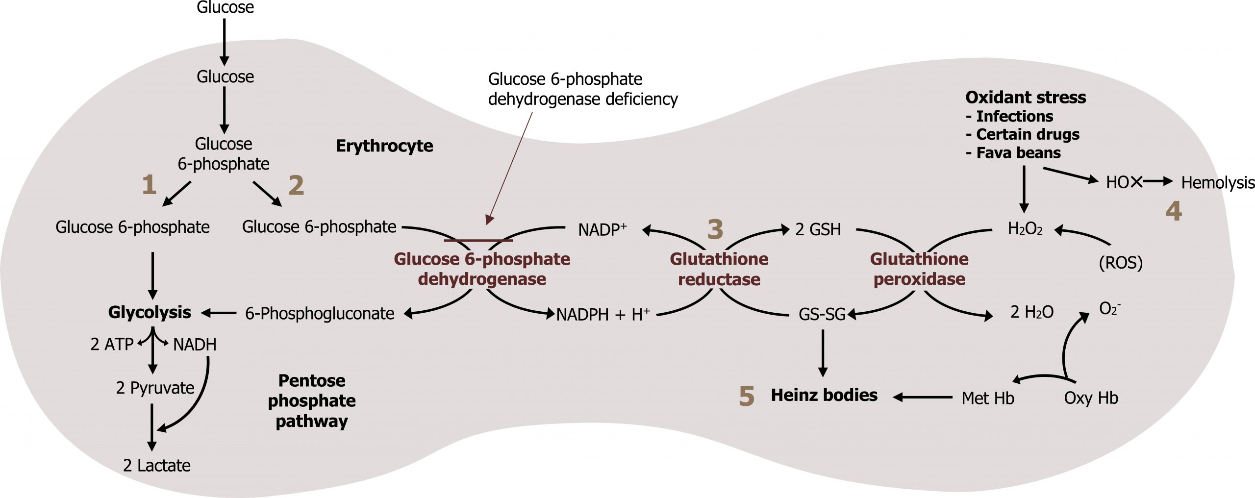 Glucose arrow into an erythrocyte to glucose 6-phosphate. Glucose 6-phosphate arrow glycolysis arrow with loss of 2 ATP and NADH to 2 pyruvate arrow 2 lactate (pentose phosphate pathway). Glucose 6-phosphate arrow with enzyme glucose 6-phosphate dehydrogenase to 6-phosphogluconate arrow to glycolysis. 3 clockwise circular arrows touching the arrow between glucose 6-phosphate to 6-phosphogluconate. NADP+ counterclockwise circular arrow with enzyme glucose 6-phosphate dehydrogenase to NADPH + H+ counterclockwise circular arrow with enzyme glutathione reductase to NADP+. Horizontal line touching arrows with glucose 6-phosphate dehydrogenase labeled glucose 6-phosphate dehydrogenase deficiency. 2 GSH clockwise circular arrow with enzyme glutathione reductase to GS-SG clockwise circular arrow with enzyme glutathione peroxidase to 2 GSH. GS-SG arrow Heinz bodies. ROS circular arrow to H2O2 counterclockwise circular arrow with enzyme glutathione peroxidase to 2 H2O. Oxidant stress: infection, certain drugs, fava beans arrows to H2O2 and HO radical. HO radical arrow hemolysis. Below circular arrow Oxy Hb arrows to O2- and MetHb. MetHb arrow Heinz bodies