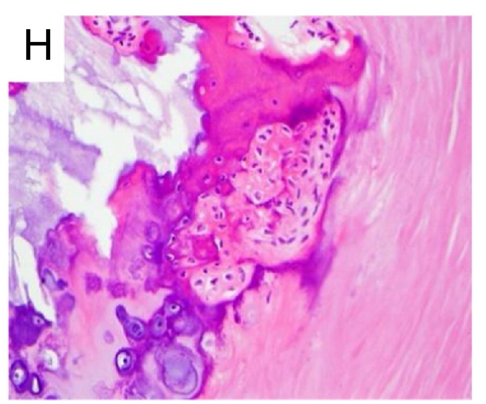 The histological slide shows several different textures of tissue types with varying degrees of pink or purple coloration. The right and left hand sides of the image shows connective tissue that is pink and smooth in appearance. The central section is a deep purple color with an island of osteocytes embedded within it. The osteocytes appear as a collection of spheres that are a lighter shade of pink with each having a dark purple, circular nucleus within.