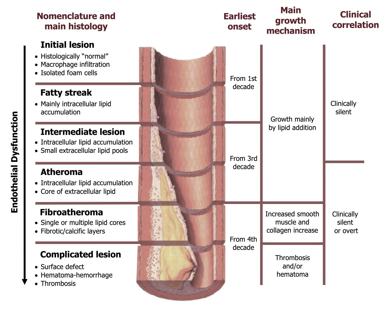 Ischemic Heart Disease – Cardiovascular Pathophysiology for Pre ...