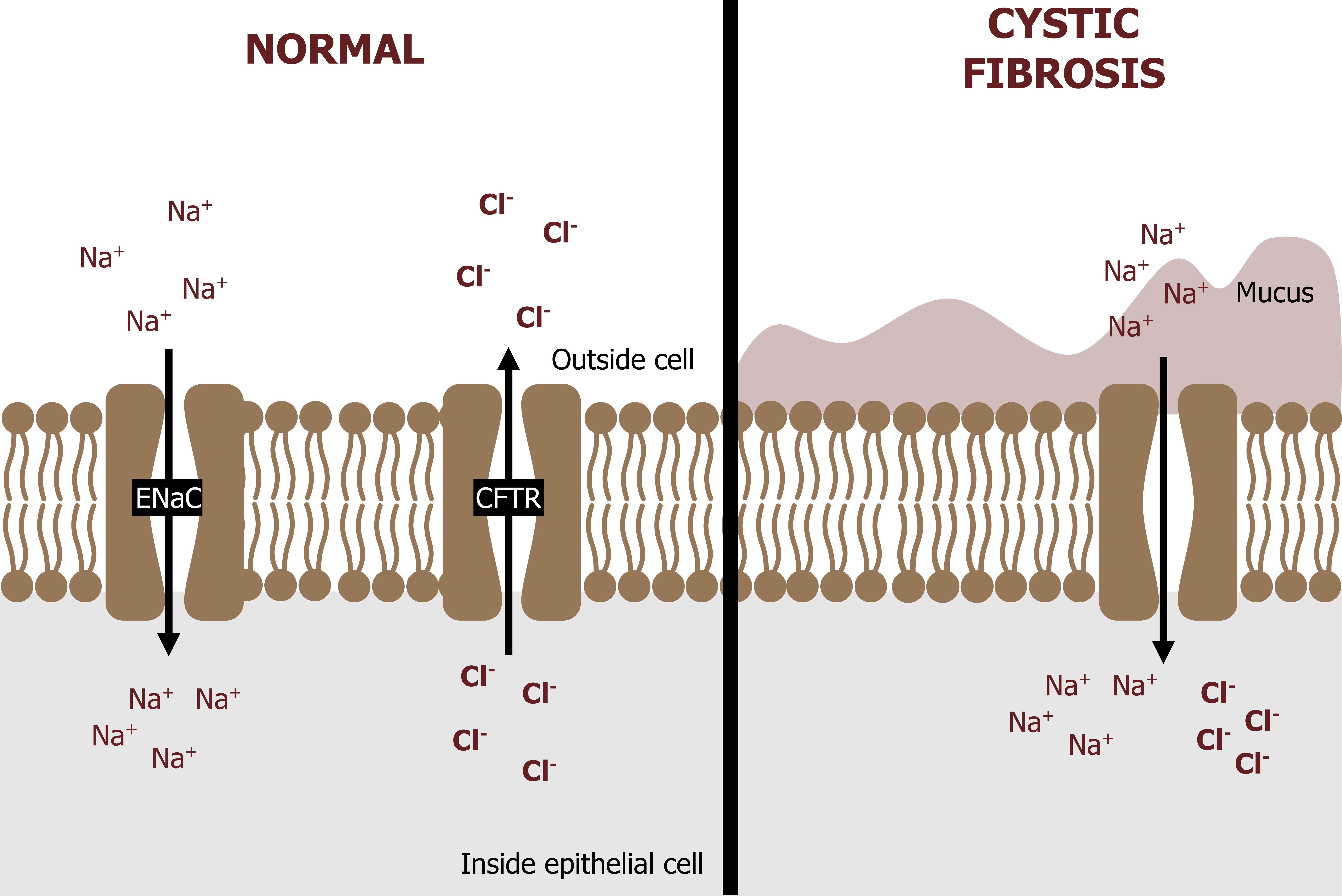 Normal epithelial cell in airway lumen: ENaC channel allowing Na+ into the cell and a CFTR channel allowing Cl- out of the cell. Cystic fibrosis epithelial cell in airway lumen: Same as normal, but CFTR channel does not open to allow Cl- to leave the cell due to mucus