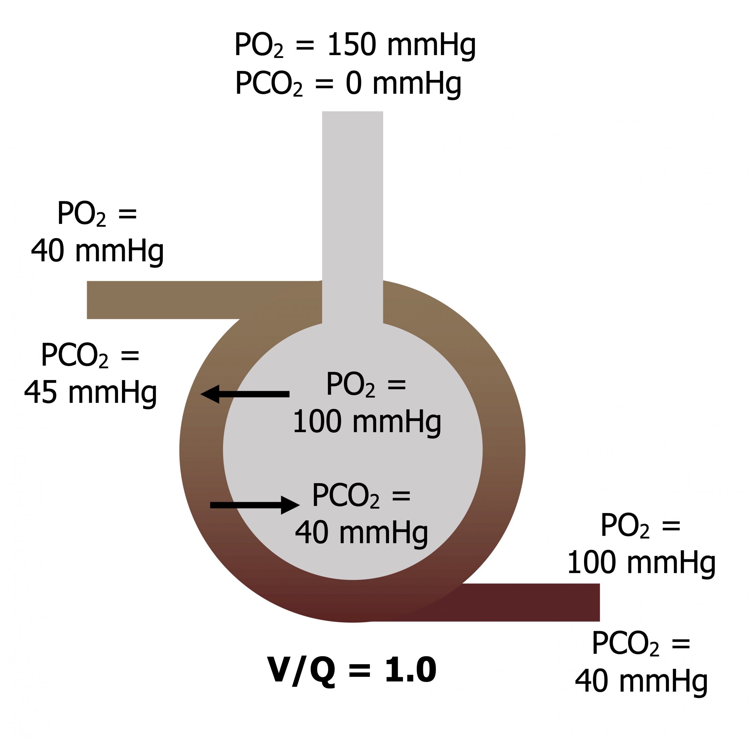 V/Q = 1. Single alveolus surrounded by blood in capillary. Inside the alveoli shows left arrow PO2 100 mmHg and right arrow PCO2 40 mmHg. Text above the alveolar duct states PO2 = 150 mmHg and PCO2 = 0 mmHg. Venous blood at the top of the alveolus with text PO2 40 mmHg and PCO2 45 mmHg. Arterial blood at the bottom of the alveolus with text PO2 100 mmHg and PCO2 40 mmHg