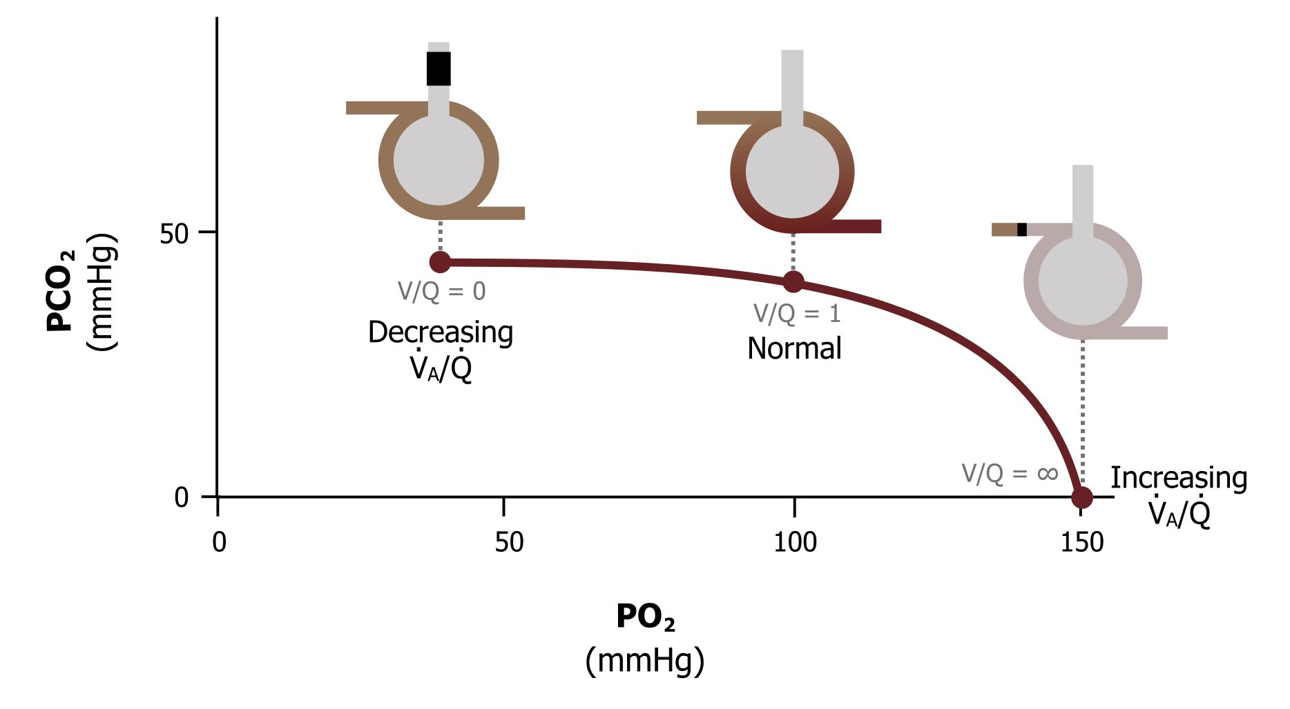 Graph with y-axis labeled PCO2 mmHg ranging from 0 to 50 and x-axis labeled PO2 mmHg ranging from 0 to 150. Normal (figure 12.2) at (11,40) with line moving to the left to decreasing VA/Q (figure 12.3) at (40, 40) and line moving to the right to increasing VA/Q (figure 12.4) at (150, 0)