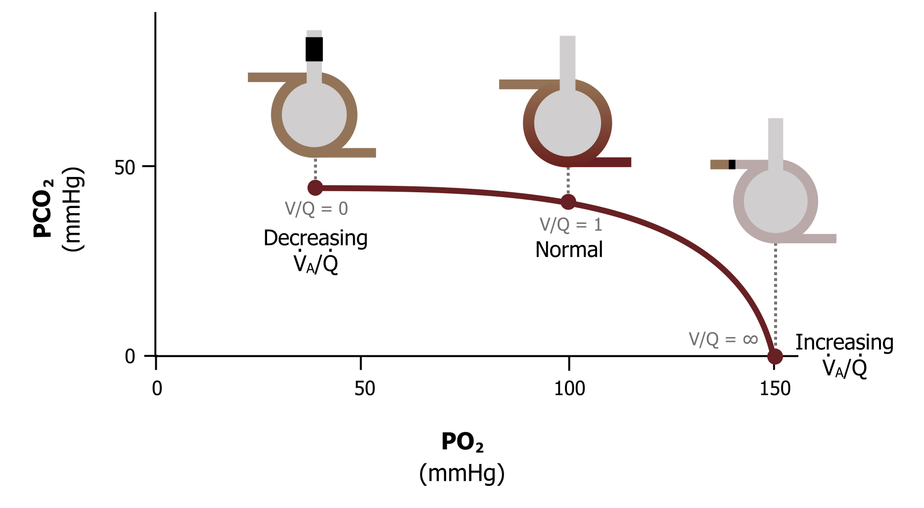 Dynamic Airway Compression – Pulmonary Physiology for Pre-Clinical Students