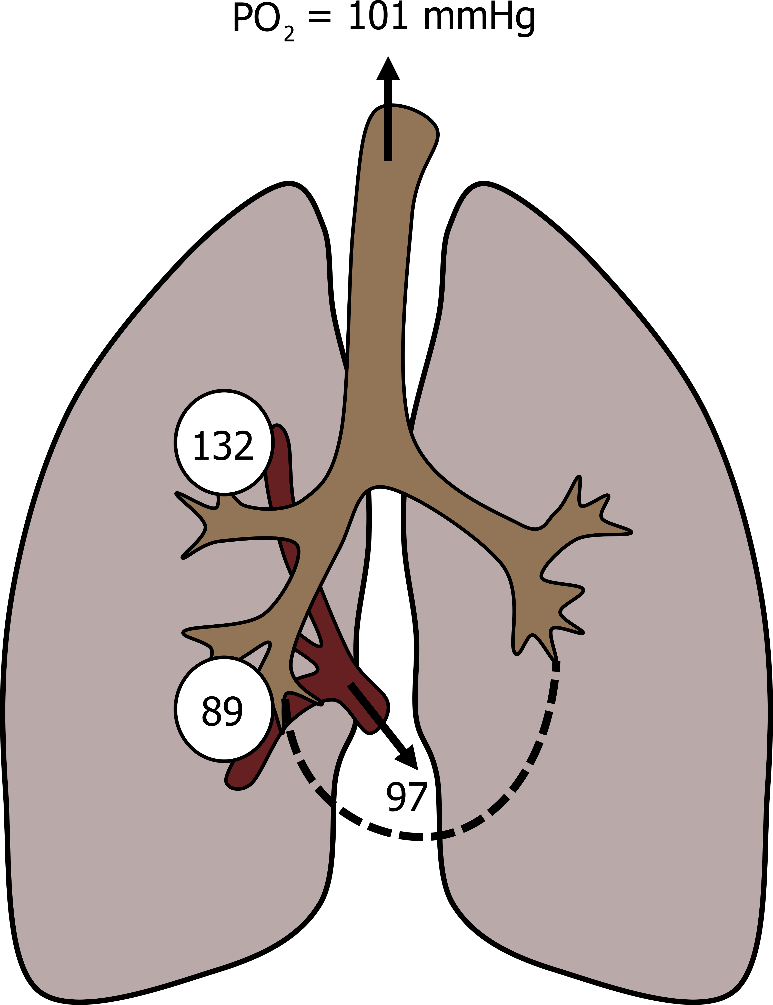 A cartoon of the lungs depicts an alveolus at the apex of one lung and an alveolus at the base. Both alveoli are connects to the trachea by airways. Branches of a blood vessel descend from each alveolus, the one from the apical alveolus is narrow, the one from the basilar alveolus is wider. The blood vessels converge as they exit the lung. At the entrance of the trachea is labelled with PO2 = 101 mmHg and an arrow in the trachea points upward. The apical alveolus as 132 written inside. The basilar alveolus has 89 written inside. The converged blood vessel has 97 written inside.