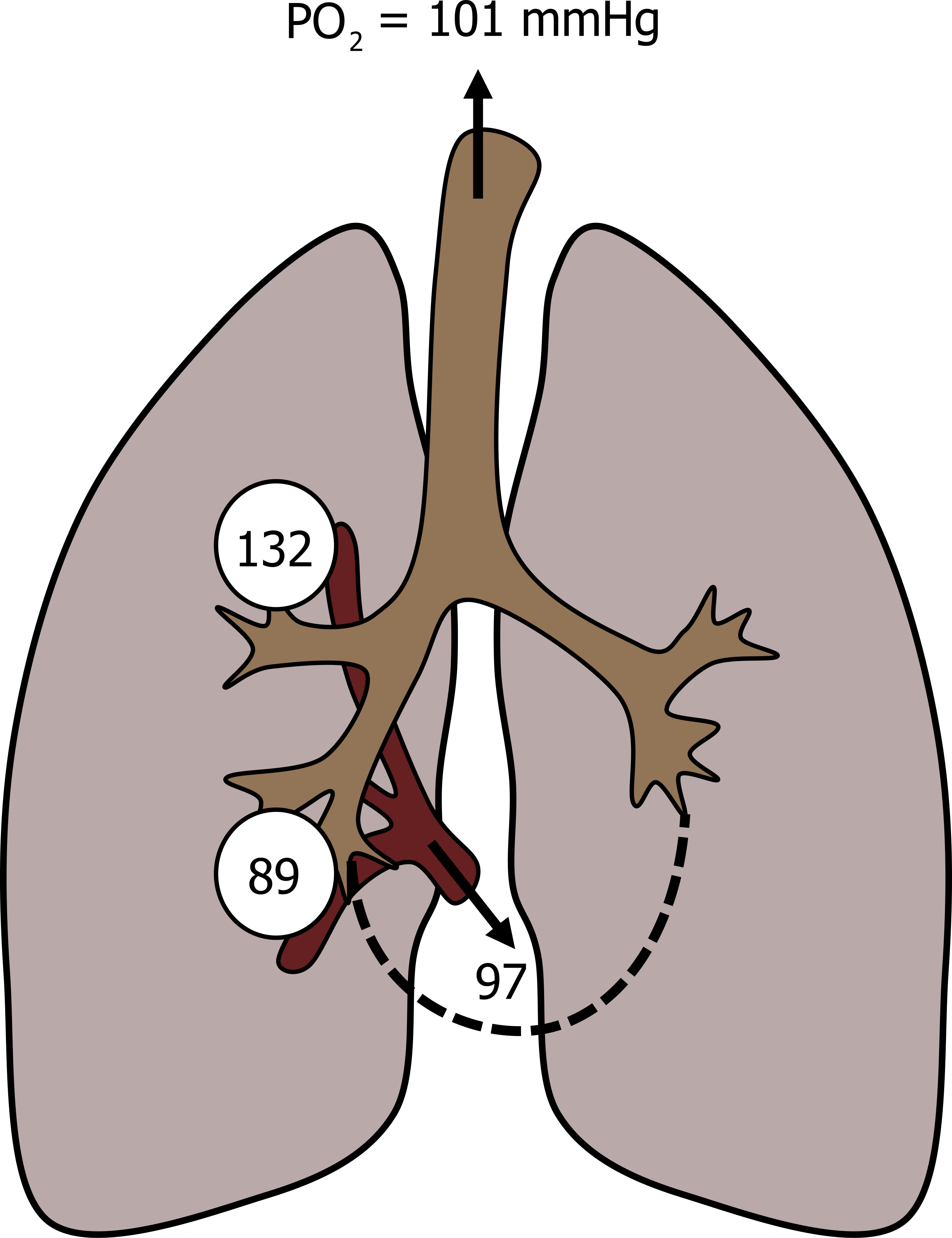 Dynamic Airway Compression – Pulmonary Physiology for Pre-Clinical