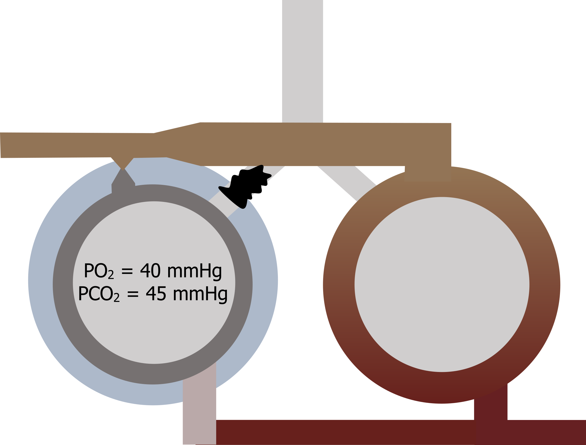 Two regions of the lung represented as circles surrounded by capillaries and connected by a branch point. The left circle is blocked by a mucous plug in the branch and has text PO2 40 mmHG and PCO2 45 mmHg. The left circle is surrounded by a light blue circle. The blood flowing in is dark blue and turns red as it leaves the right circle.