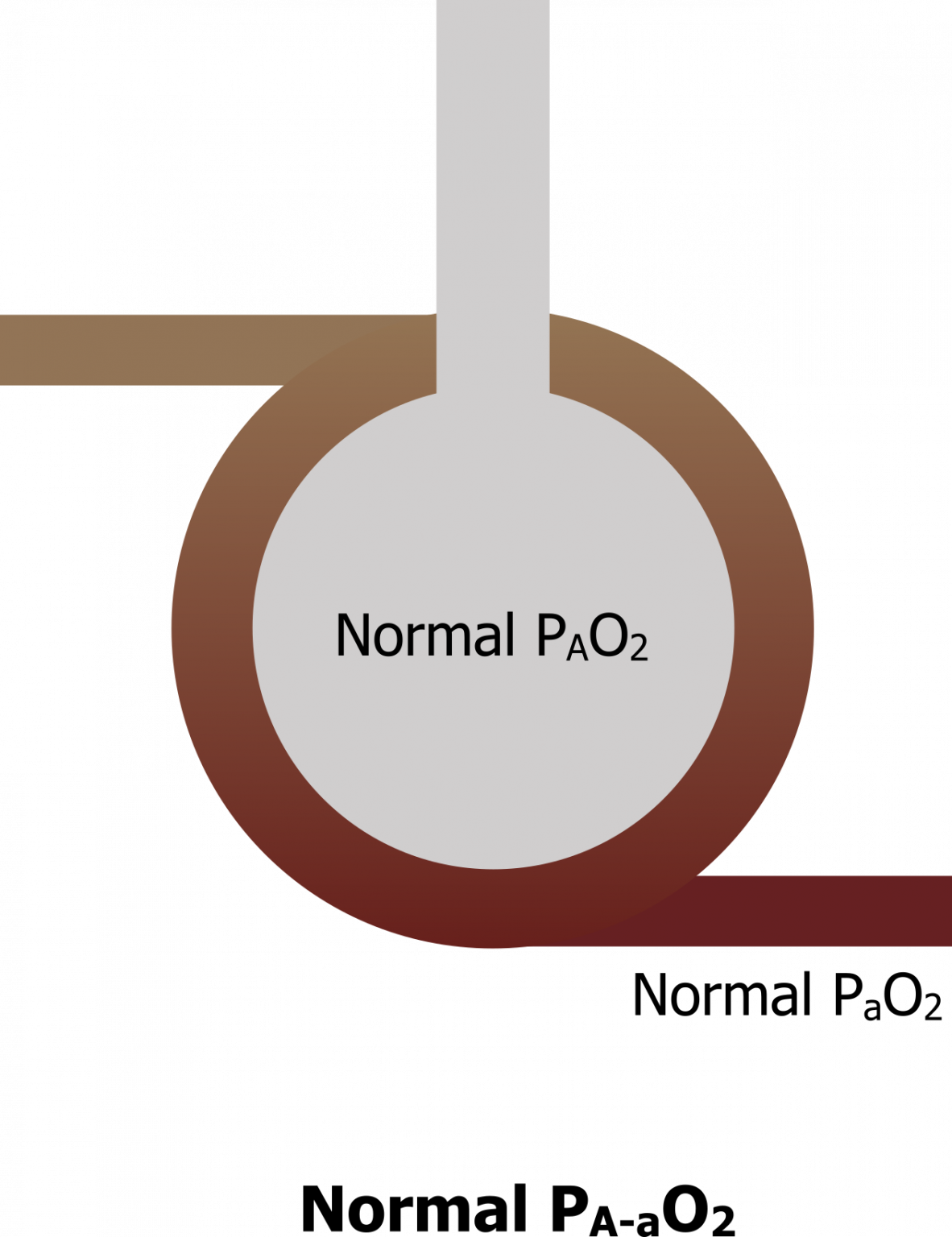 The Alveolar Gas Equation and Alveolar–Arterial PO2 Difference ...