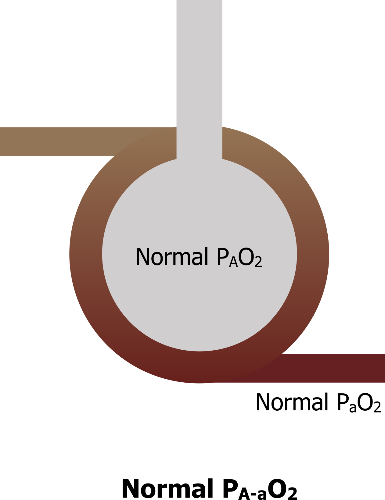 Normal PA-aO2. Alveolus with text Normal PAO2. Deoxygenated blood enters the surrounding capillaries and leaves oxygenated with text Normal PaO2.