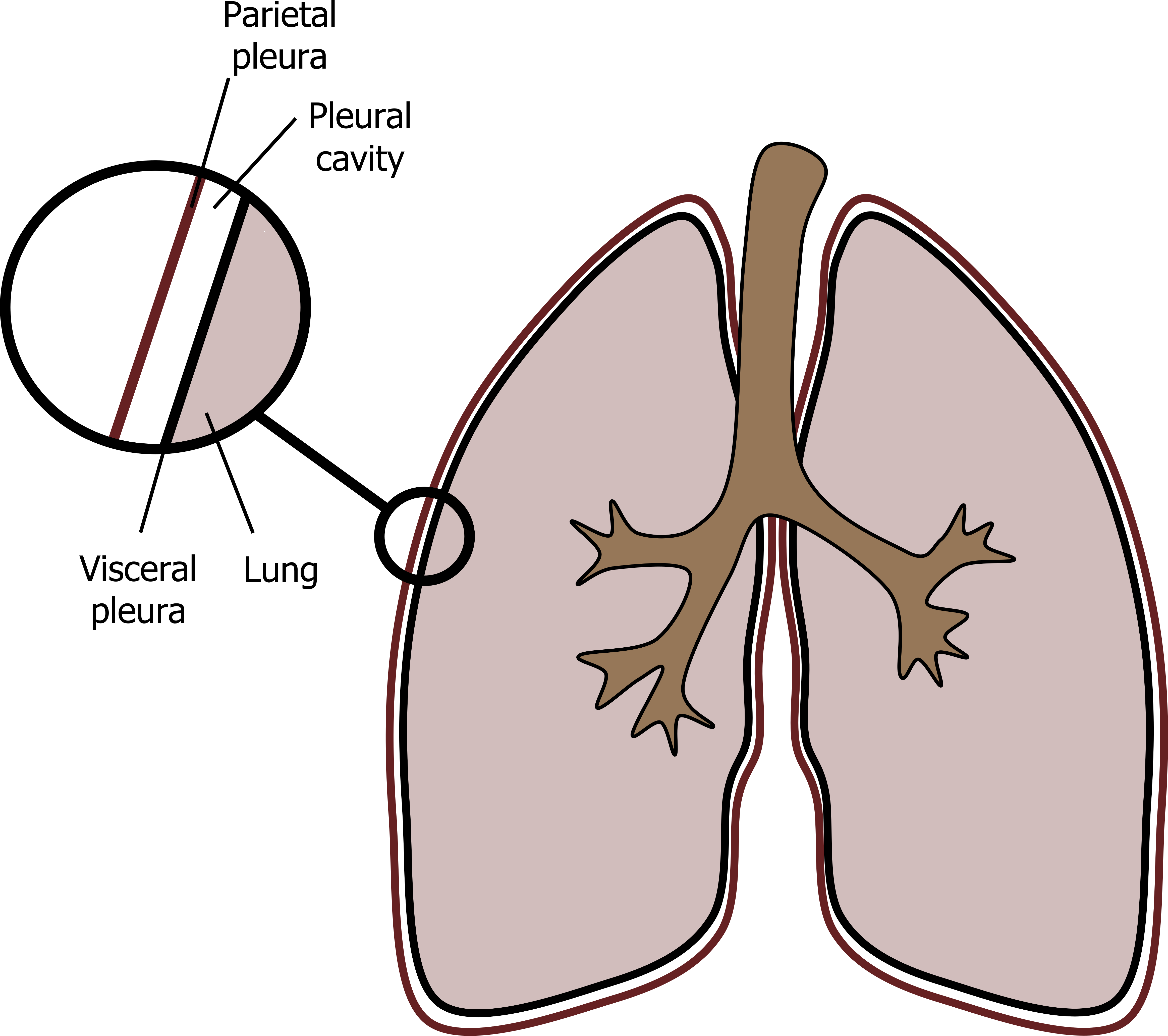 Figure depicts cartoon lungs. There is a zoomed in circle of the outside of the lungs which show from outside to inside parietal pleura, pleural cavity, visceral pleura, lung.