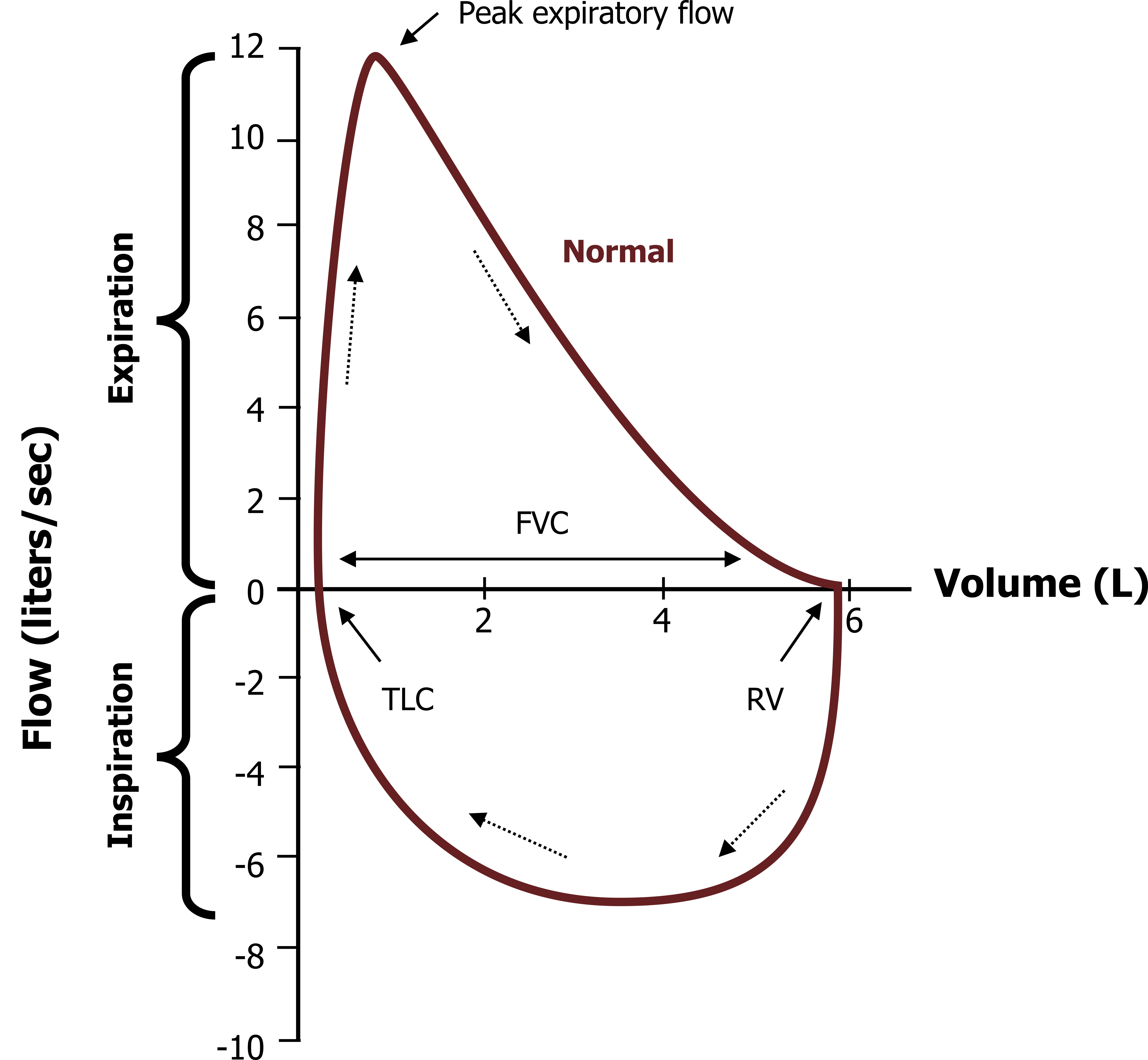 Graph with x-axis labeled Flow (Is-1) ranging from bottom to top 10 to 0 labeled inspiration 0-10 expiration and y-axis at x=0 labeled Volume (L) ranging from left to right 6, 4, 2. Expiration: Parabolic graph with right skew beginning at (8,0), peaking at (8,10) labeled peak respiratory flow, and ending at (2,0). Bidirectional arrow labeled FVC along the x-axis. Inspiration: line in half circle shape from (2,0) labeled TLC to (8,0) labeled RV. Arrows pointing clockwise within the shape of the connected graphs. All values are approximate.