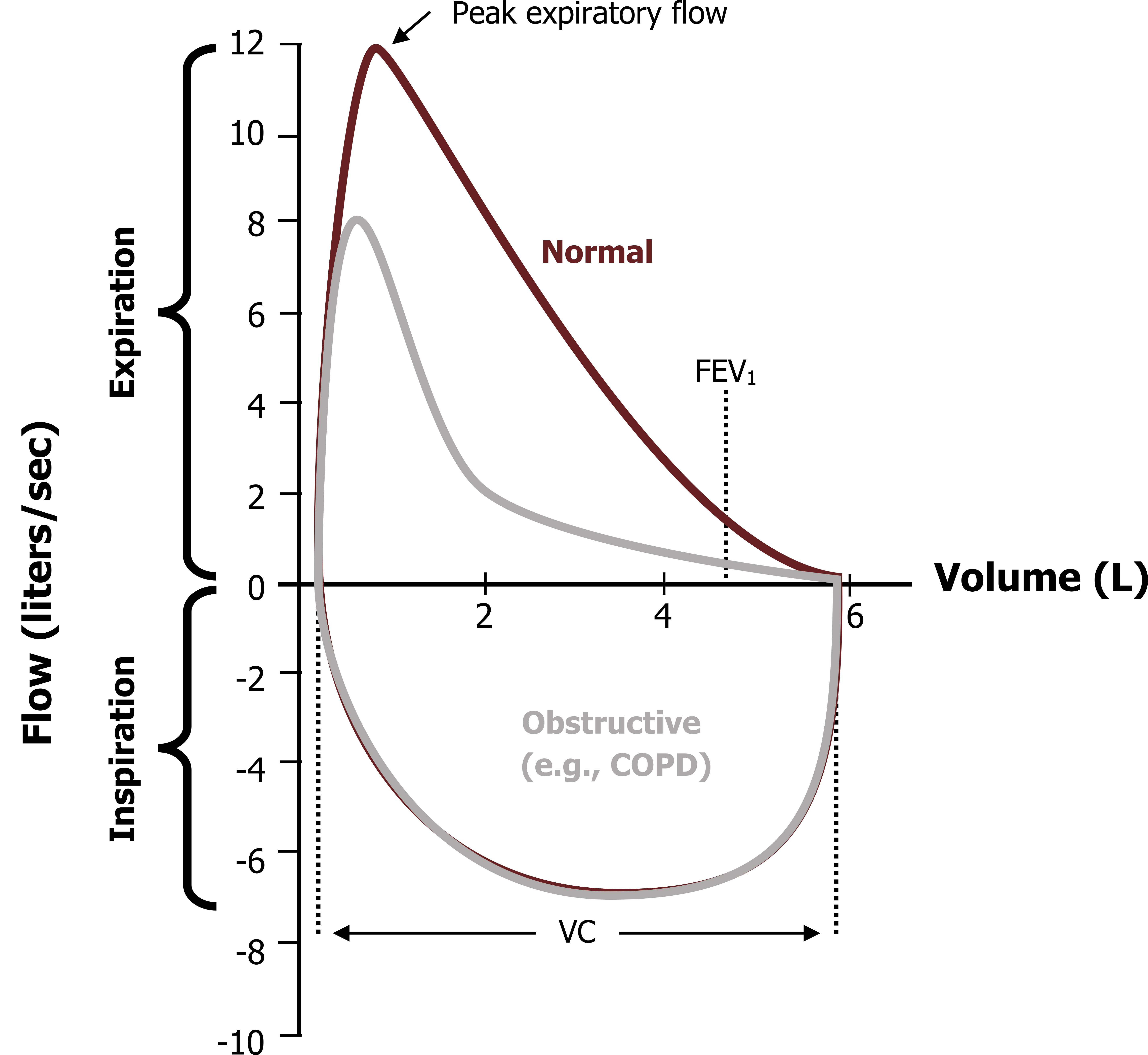 What is dynamic compression (related to the respiratory system)? - Quora