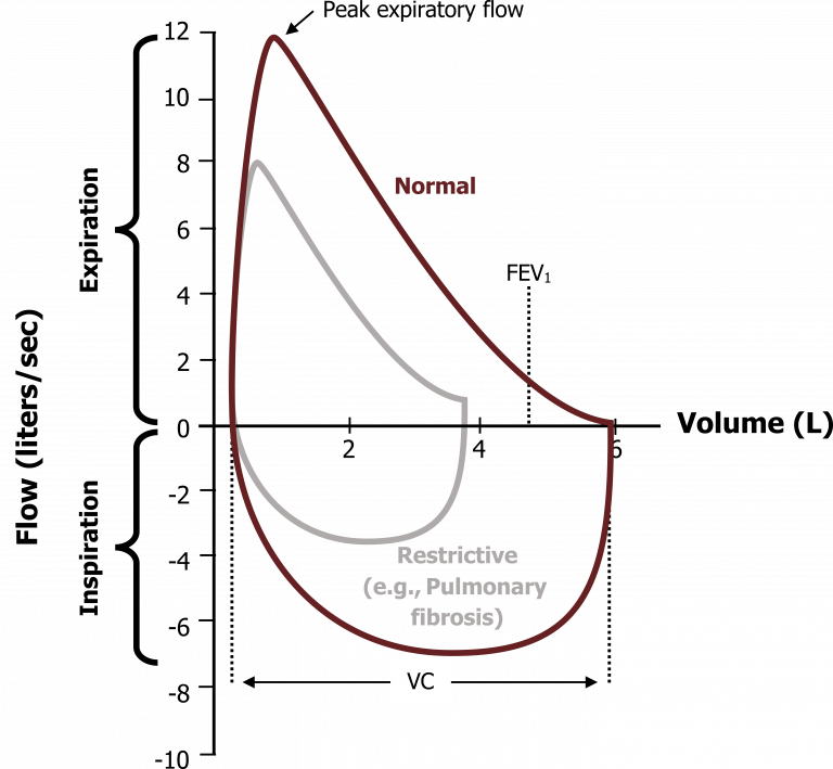 Dynamic Airway Compression – Pulmonary Physiology for Pre-Clinical Students