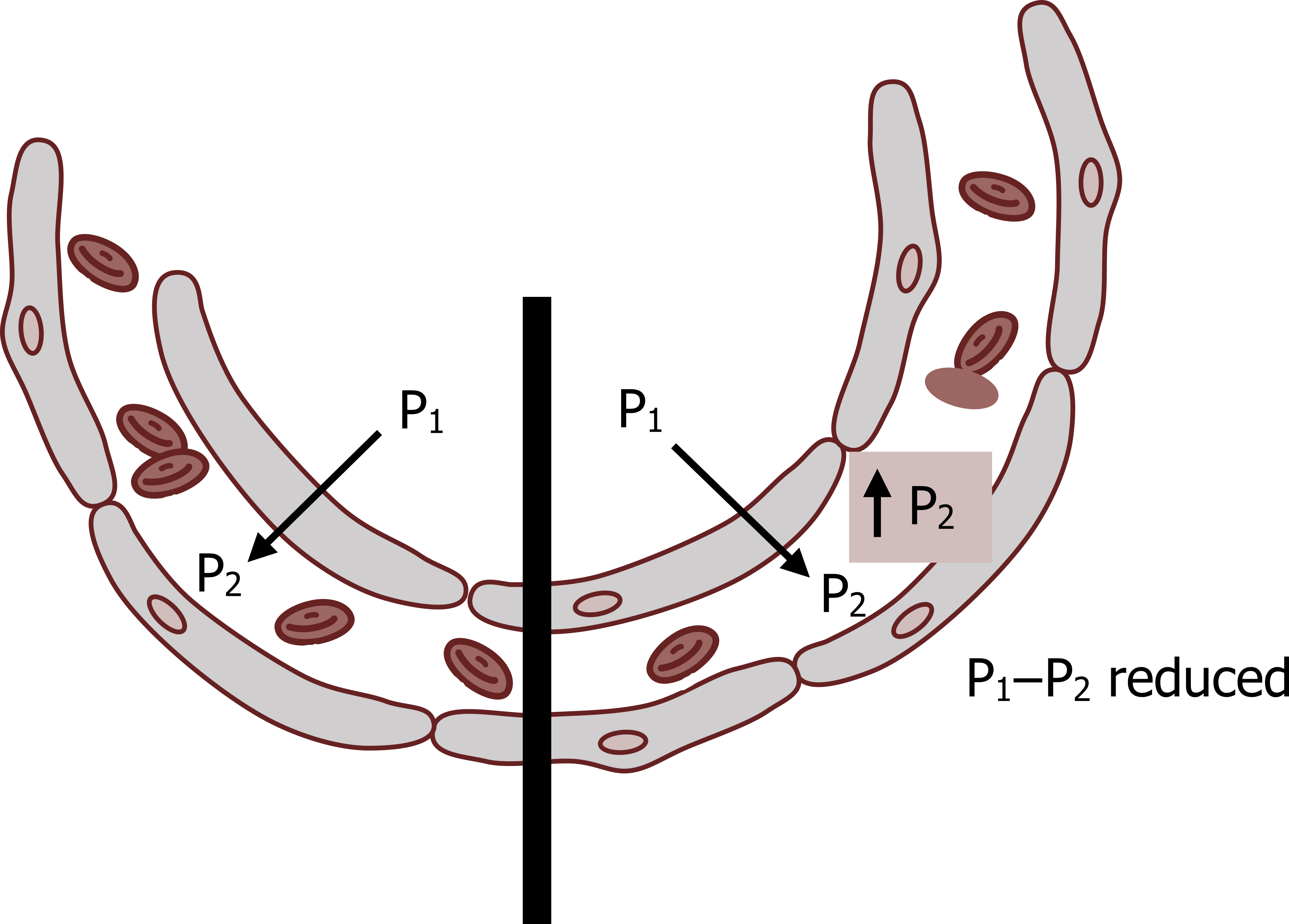 The image shows a cartoon of a capillary passing a single alveolus. A black line separates the structure into two halves to depict diffusion limitation to the left of the line and perfusion limitation to the right. On both sides, P1 is written inside the alveolus with P2 inside the capillary. An arrow goes from P1 to P2. On the right side a box with an up-arrow and P2 is include inside the capillary and there is an annotation that P1-P2 is reduced.